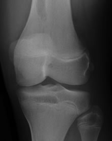 side image1